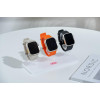 XO smart watch 3-position display frame